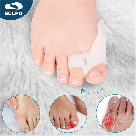 Silikonski Korektor Palca 1+1 Gratis – Za Čuklj i Bol u Stopalima